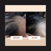 QiRah 3-Month Hair Repair Plan (100 ml ร 3) ๐ฅ Best Value Pack โ Save More Every Month
